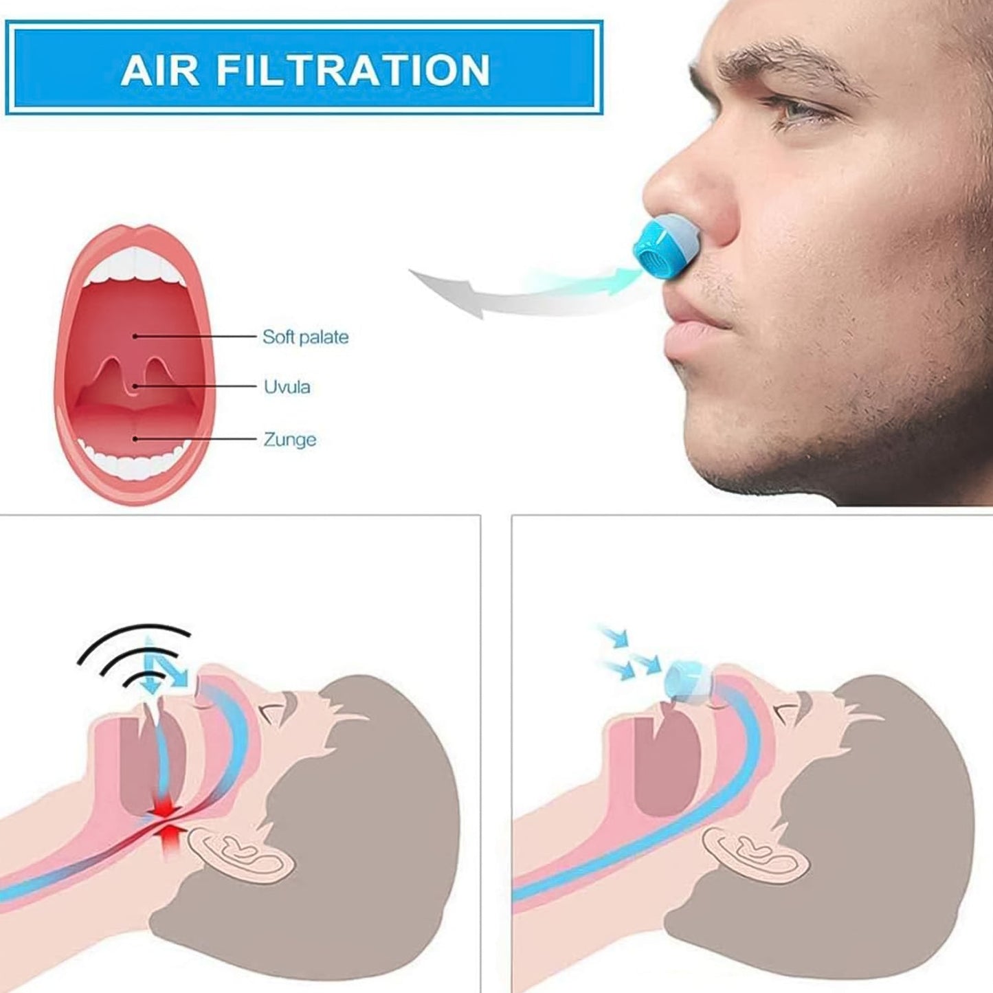 2 in 1 Anti Snoring Nose Clip with Air Purifier & Storage Case (1 Pc)
