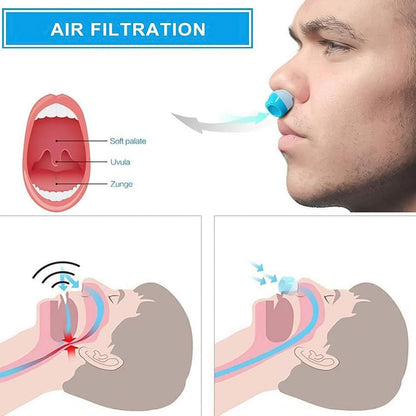 2 in 1 Anti Snoring Nose Clip with Air Purifier & Storage Case (1 Pc)