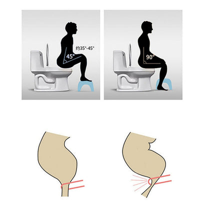 Plastic Non-Slip Folding Toilet Squat Stool – White (Compact Design)